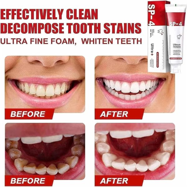 Yayashi SP-4 Ultra Whitening Probiotic Toothpaste – Stain Remover, Gum Care & Fresh Breath Formula